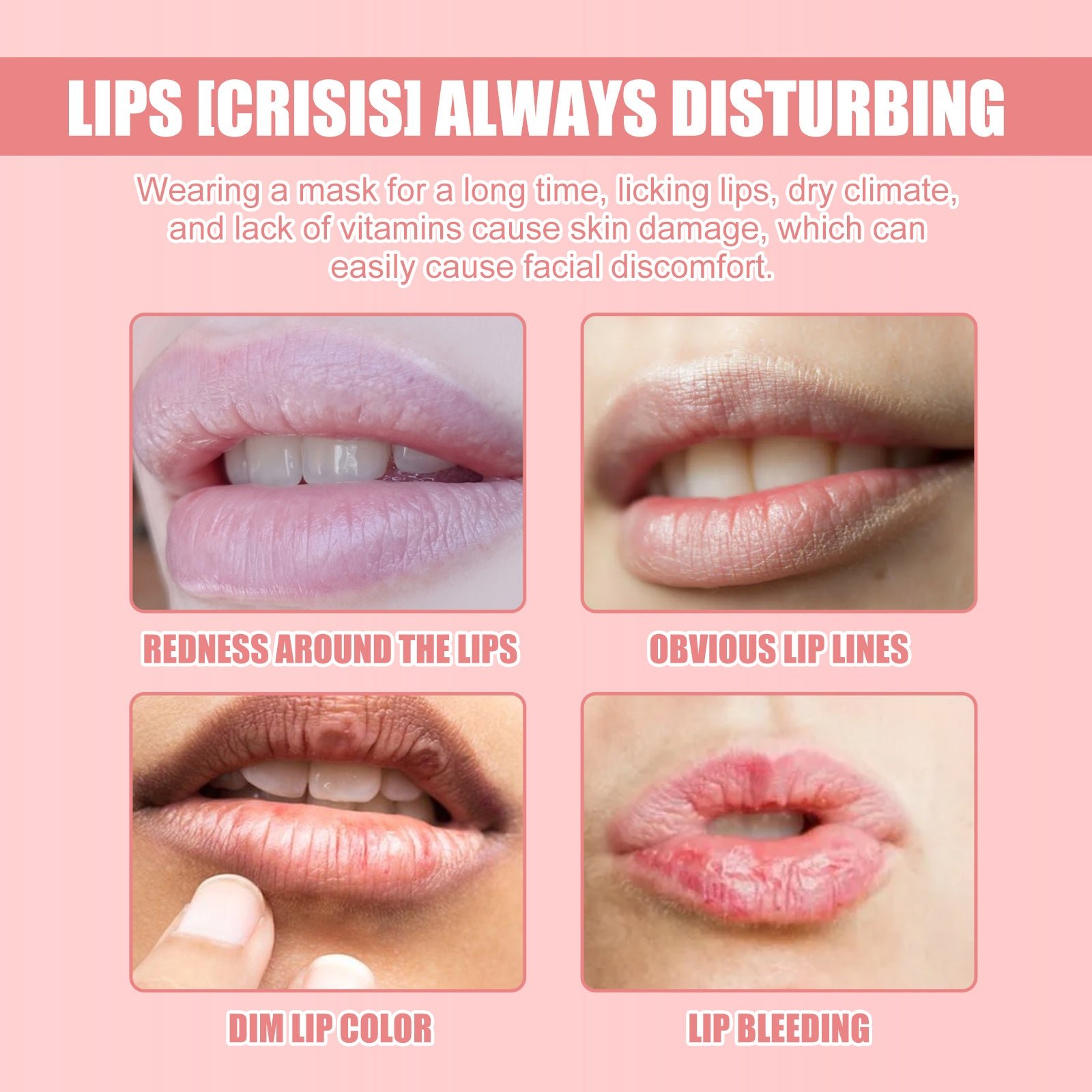 EELHOE Lip Mask Lightening Lip Lines, Hydrating, Moisturizing, Removing Dead Skin, Anti-Freezing And Cracking, Non-Greasy And Easy To Absorb Lip Balm